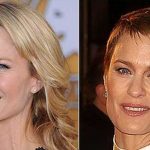 Robin Wright before and after plastic surgery 4