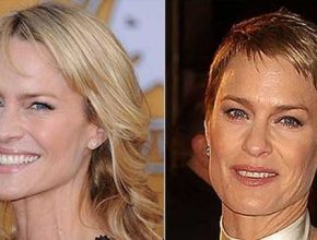 Robin Wright before and after plastic surgery 4