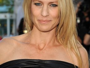 Robin Wright plastic surgery 13