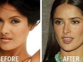 Salma Hayek before and after plastic surgery 1