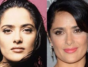Salma Hayek before and after plastic surgery 47