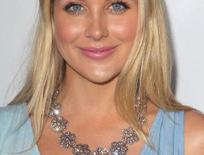 Stephanie Pratt plastic surgery 13