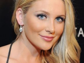 Stephanie Pratt plastic surgery 19