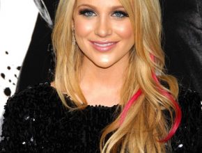 Stephanie Pratt plastic surgery 4