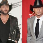 Tim Mcgraw before and after plastic surgery 28
