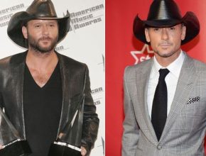 Tim Mcgraw before and after plastic surgery 28