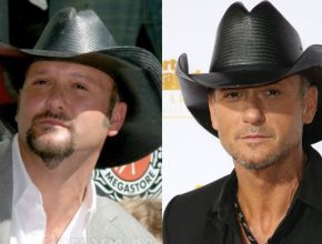 Tim Mcgraw before and after plastic surgery 30