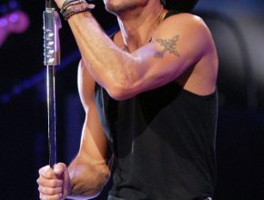 Tim Mcgraw plastic surgery 11