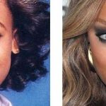 Tyra Banks before and after plastic surgery 22