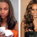 Tyra Banks before and after plastic surgery 23