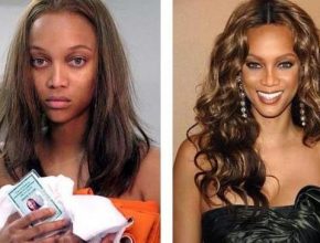 Tyra Banks before and after plastic surgery 23