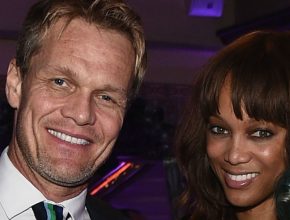 Tyra Banks plastic surgery 20