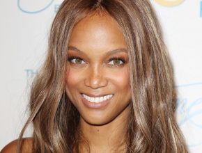 Tyra Banks plastic surgery 27