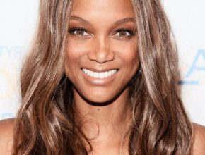 Tyra Banks plastic surgery 44