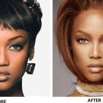 Tyra Banks plastic surgery 45