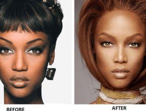 Tyra Banks plastic surgery 45