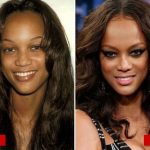 Tyra Banks plastic surgery before and after 3