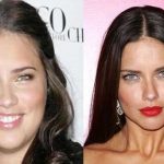 Adriana Lima before and after plastic surgery 14