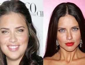 Adriana Lima before and after plastic surgery 14