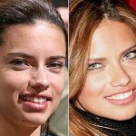 Adriana Lima before and after plastic surgery 16