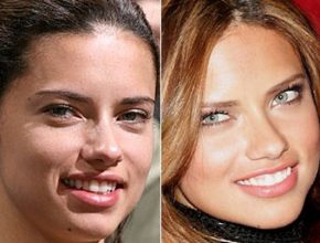 Adriana Lima before and after plastic surgery 16