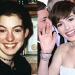 Anne Hathaway before and after plastic surgery 39