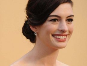 Anne Hathaway Plastic Surgery 25