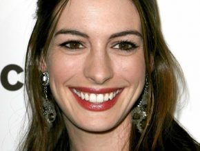 Anne Hathaway Plastic Surgery 30