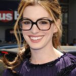 Anne Hathaway Plastic Surgery 56