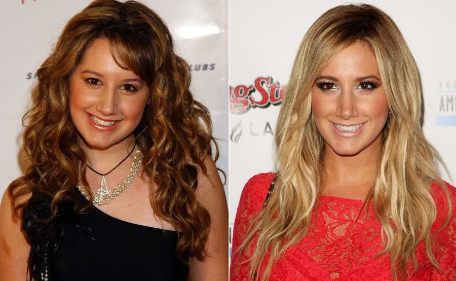 Ashley Tisdale before and after plastic surgery