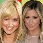 Ashley Tisdale before and after plastic surgery 20