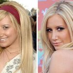 Ashley Tisdale plastic surgery 01