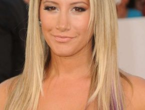 Ashley Tisdale plastic surgery 11