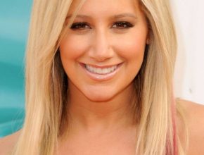 Ashley Tisdale plastic surgery 38