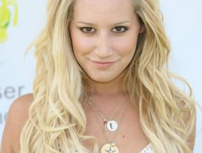 Ashley Tisdale plastic surgery