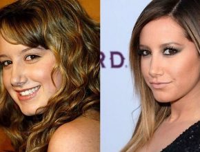 Ashley Tisdale plastic surgery 44