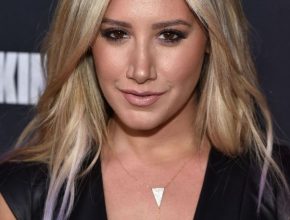 Ashley Tisdale plastic surgery 6