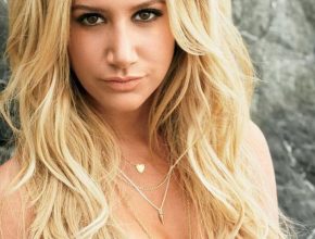 Ashley Tisdale plastic surgery 7