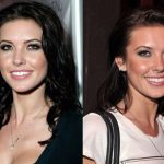 Audrina Patridge before and after plastic surgery 12