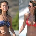 Audrina Patridge before and after plastic surgery 2