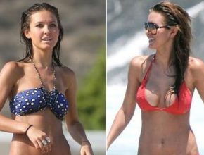 Audrina Patridge before and after plastic surgery 2