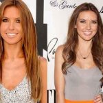 Audrina Patridge before and after plastic surgery 41