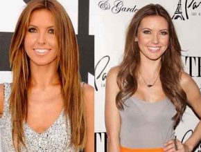 Audrina Patridge before and after plastic surgery 41