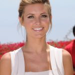 Audrina Patridge plastic surgery 35