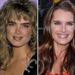 Brooke Shields before and after plastic surgery 01