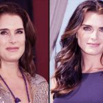 Brooke Shields before and after plastic surgery 45