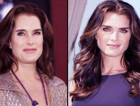 Brooke Shields before and after plastic surgery 45