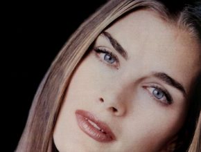 Brooke Shields plastic surgery 28