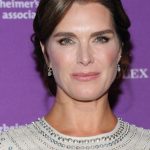 Brooke Shields plastic surgery 34