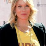 Christina Applegate plastic surgery 10